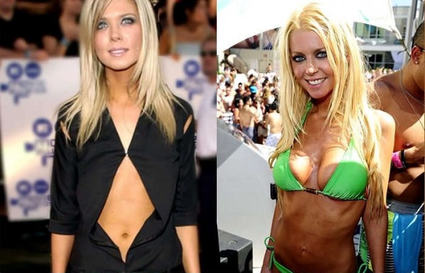 3-Tara-Reid-Plastic-Surgery1