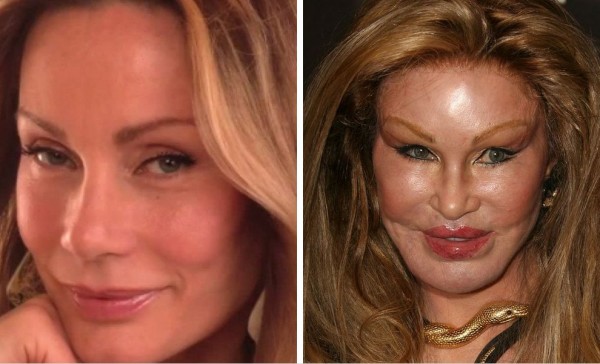 9-Jocelyn-Wildenstein-before-after