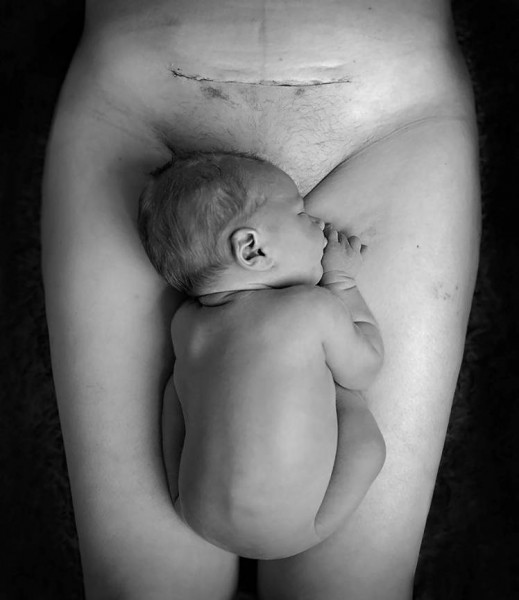 This striking photograph of a mother and baby taken just three days after being born by caesarean section has been shared more than 56,000 times on Facebook. Helen Aller, 29, from Guernsey, who is eight months pregnant, took the black and white image of the unnamed woman - who was scared of having a C-section - and her newborn lying next to her wound.  The image touched a nerve around the world after Helen shared it online, and it has been seen 11.5 million times and liked by nearly 200,000. Helen, a mother-of-two, posted on Facebook: 'I didn't expect this image to reach so far.