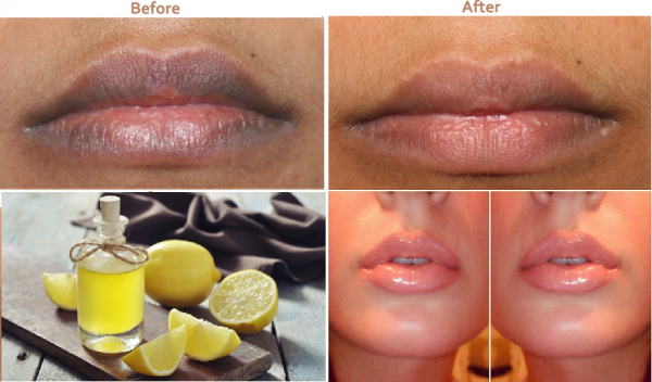 Homemade-Beauty-Remedy-for-Dark-Lips