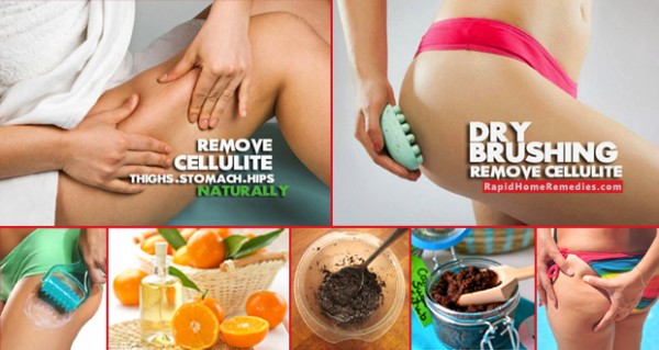 Top-Remedies-for-Cellulite-Removal