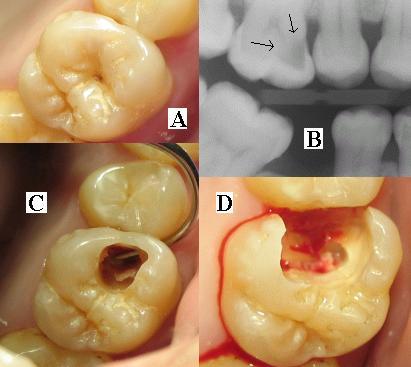 ToothMontage3